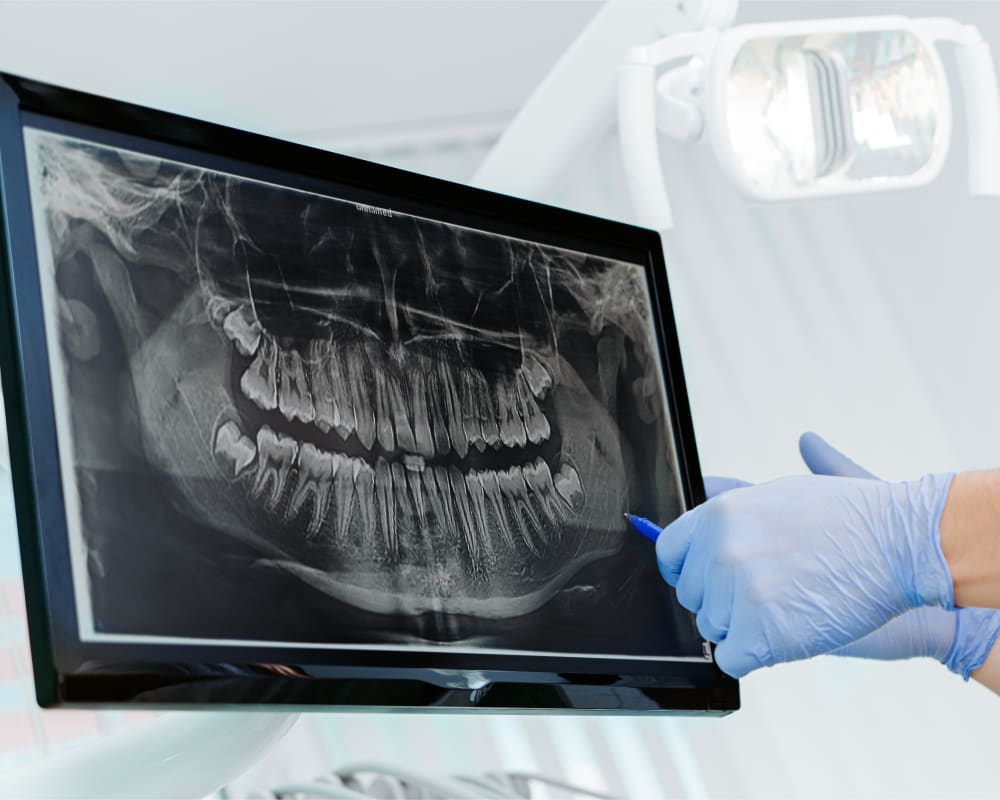 A dental professional points to a panoramic X-ray.
